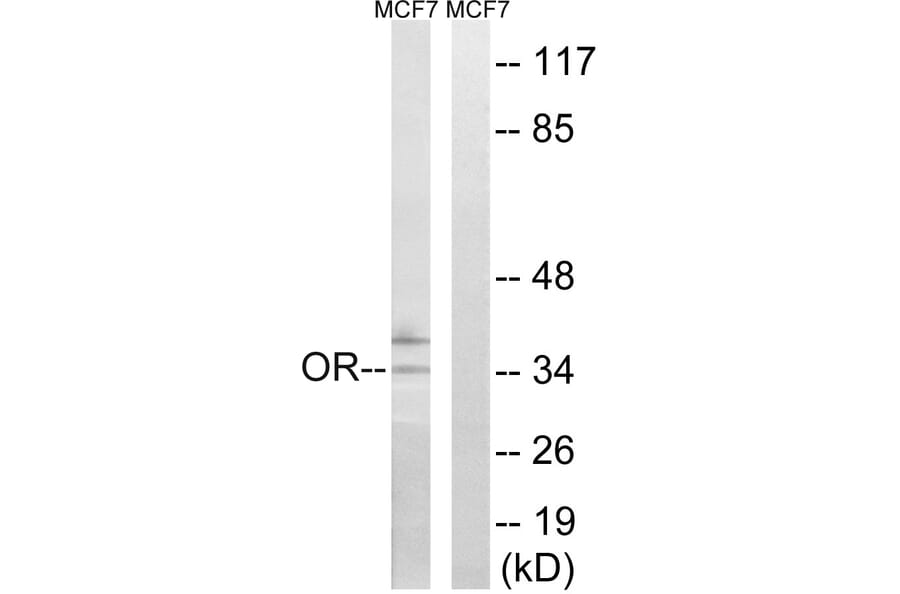 Western Blot - Anti-OR51H1 Antibody (G848) - Antibodies.com
