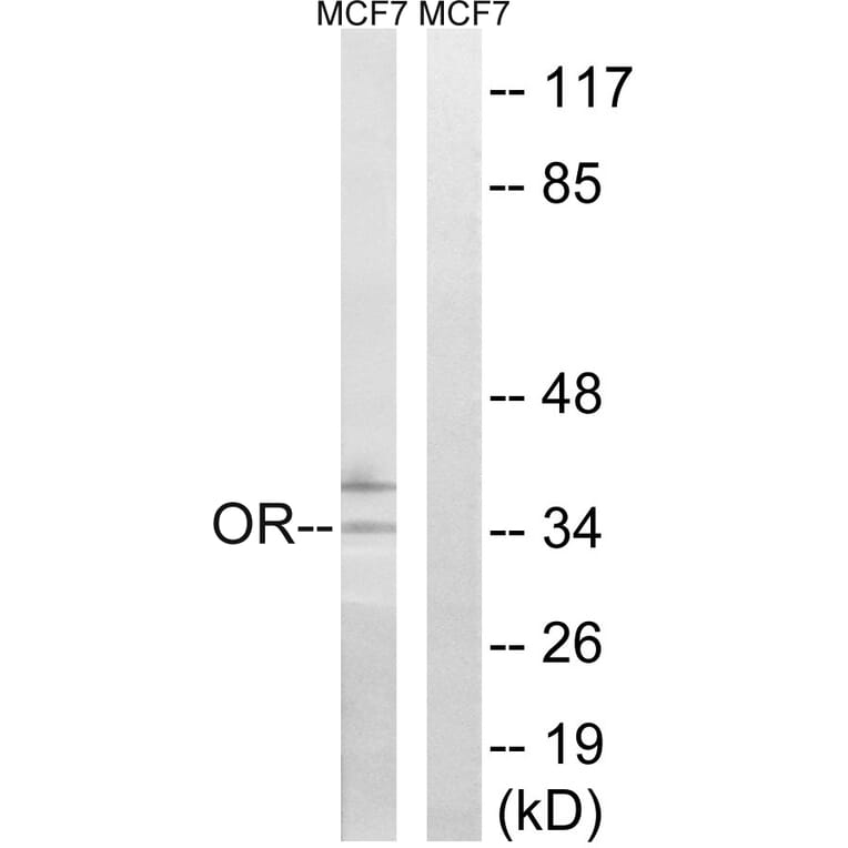 Western Blot - Anti-OR51H1 Antibody (G848) - Antibodies.com