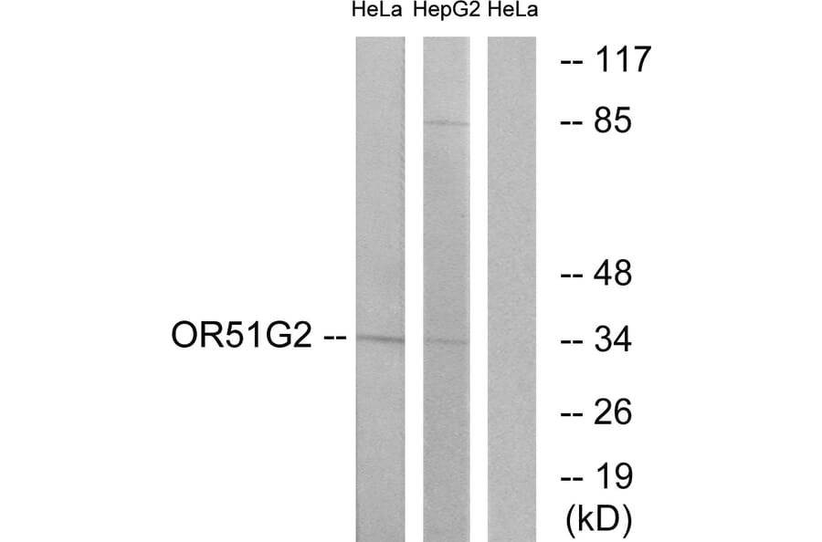 Western Blot - Anti-OR51G2 Antibody (G448) - Antibodies.com