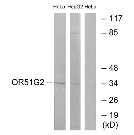 Western Blot - Anti-OR51G2 Antibody (G448) - Antibodies.com