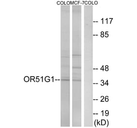 Western Blot - Anti-OR51G1 Antibody (G847) - Antibodies.com