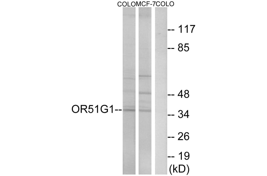 Western Blot - Anti-OR51G1 Antibody (G847) - Antibodies.com