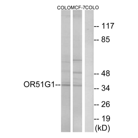 Western Blot - Anti-OR51G1 Antibody (G847) - Antibodies.com