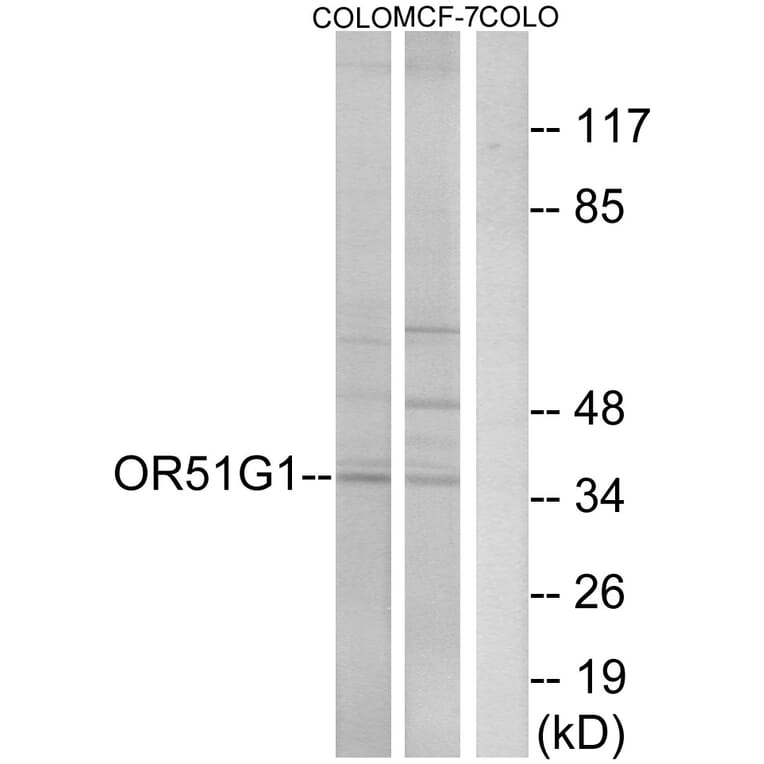 Western Blot - Anti-OR51G1 Antibody (G847) - Antibodies.com