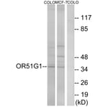 Western Blot - Anti-OR51G1 Antibody (G847) - Antibodies.com