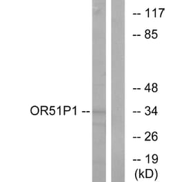 Western Blot - Anti-OR51D1 Antibody (G621) - Antibodies.com