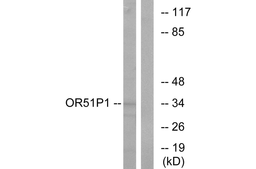 Western Blot - Anti-OR51D1 Antibody (G621) - Antibodies.com