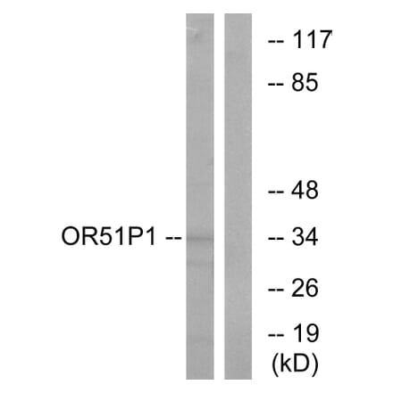 Western Blot - Anti-OR51D1 Antibody (G621) - Antibodies.com