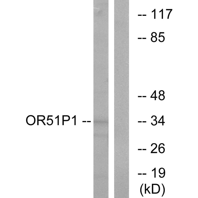 Western Blot - Anti-OR51D1 Antibody (G621) - Antibodies.com