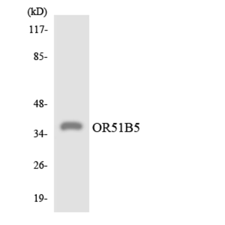 Western Blot - Anti-OR51B5 Antibody (R12-3203) - Antibodies.com