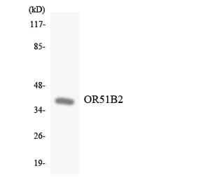 Western Blot - Anti-OR51B2 Antibody (R12-3202) - Antibodies.com