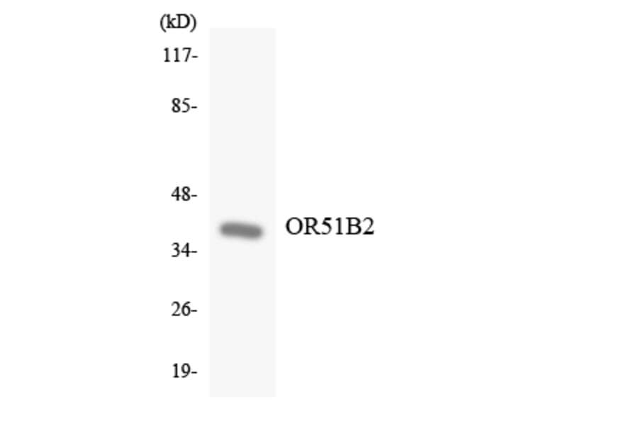 Western Blot - Anti-OR51B2 Antibody (R12-3202) - Antibodies.com