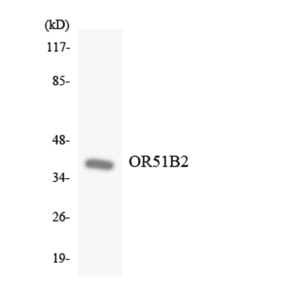 Western Blot - Anti-OR51B2 Antibody (R12-3202) - Antibodies.com