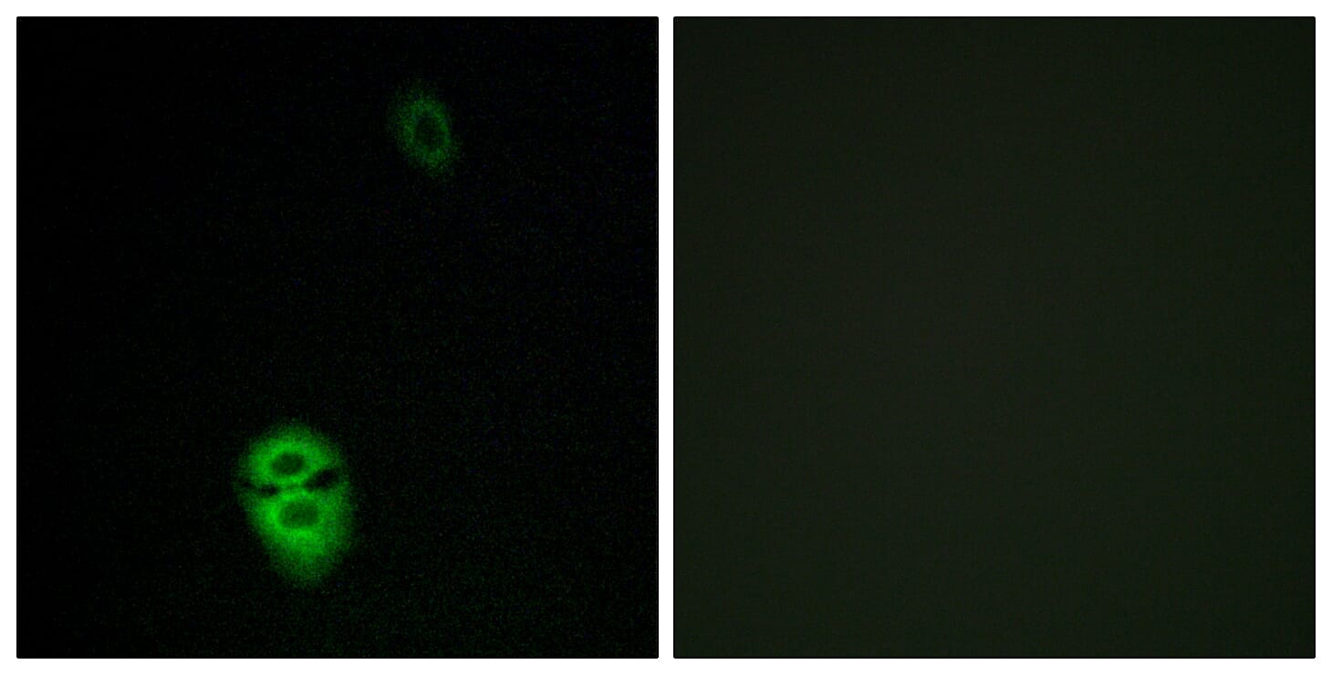 Immunofluorescence analysis of A549 cells using Anti-OR4K17 Antibody. The right hand panel represents a negative control, where the antibody was pre-incubated with the immunising peptide.