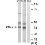 Western Blot - Anti-OR4K14 Antibody (G679) - Antibodies.com