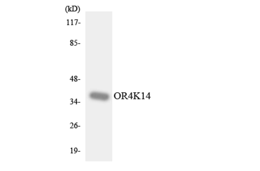 Western Blot - Anti-OR4K14 Antibody (R12-3191) - Antibodies.com