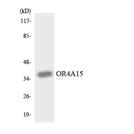 Western Blot - Anti-OR4A15 Antibody (R12-3179) - Antibodies.com
