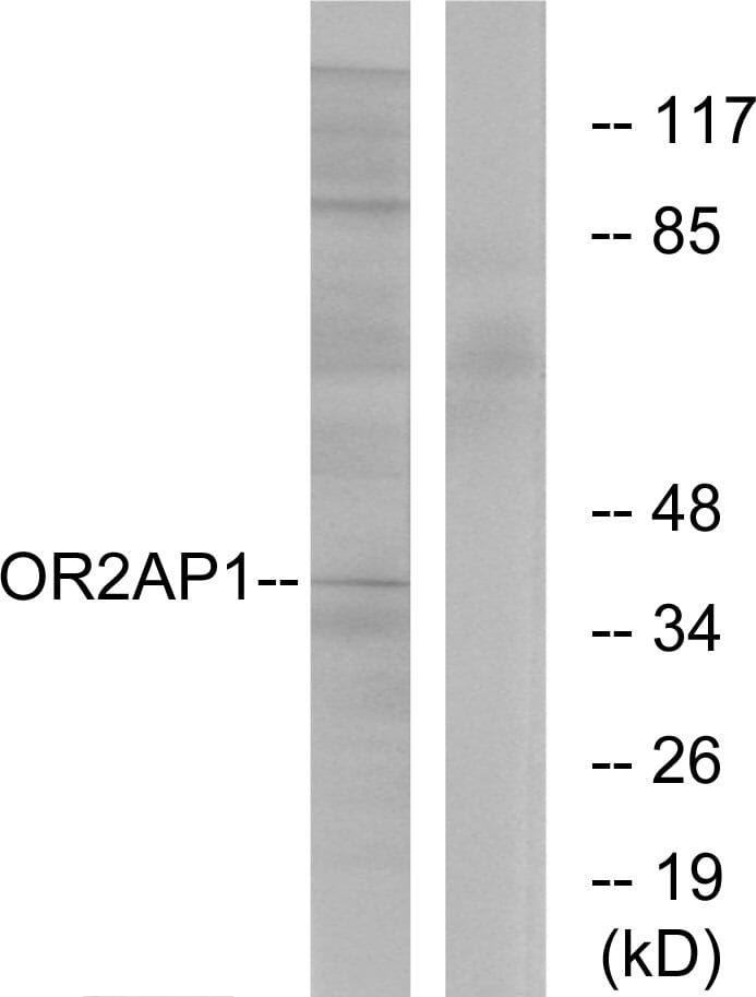 Western blot analysis of lysates from Jurkat cells using Anti-OR2AP1 Antibody. The right hand lane represents a negative control, where the antibody is blocked by the immunising peptide.