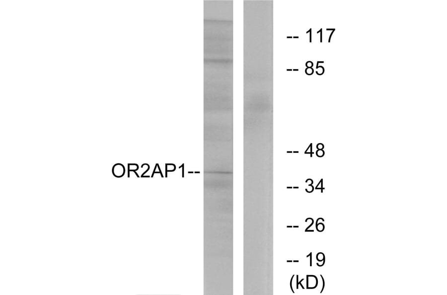 Western Blot - Anti-OR2AP1 Antibody (G435) - Antibodies.com