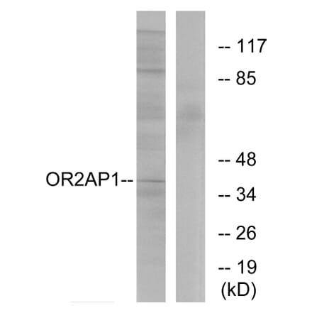 Western Blot - Anti-OR2AP1 Antibody (G435) - Antibodies.com