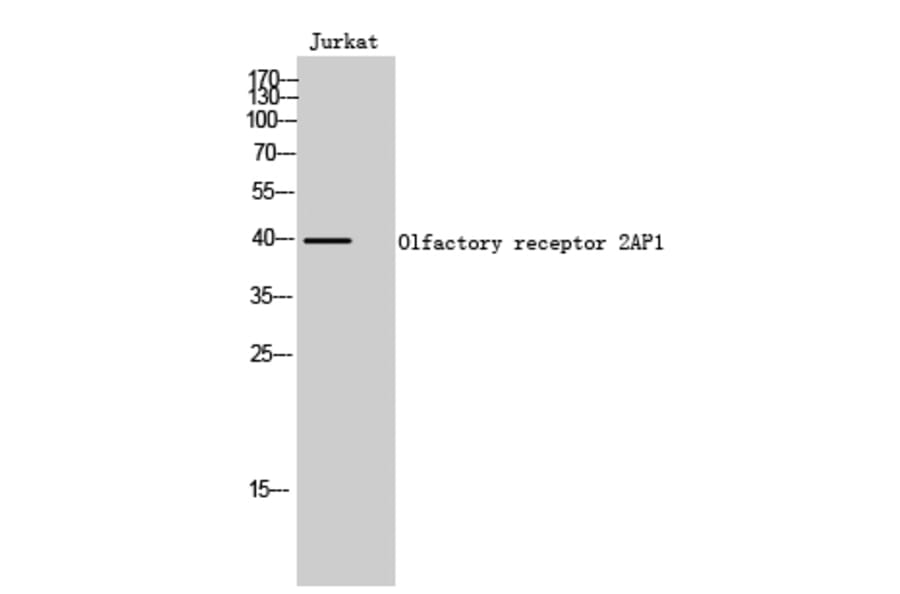 Western Blot - Anti-OR2AP1 Antibody (G435) - Antibodies.com