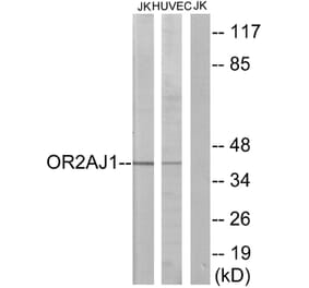 Western Blot - Anti-OR2AJ1 Antibody (G433) - Antibodies.com