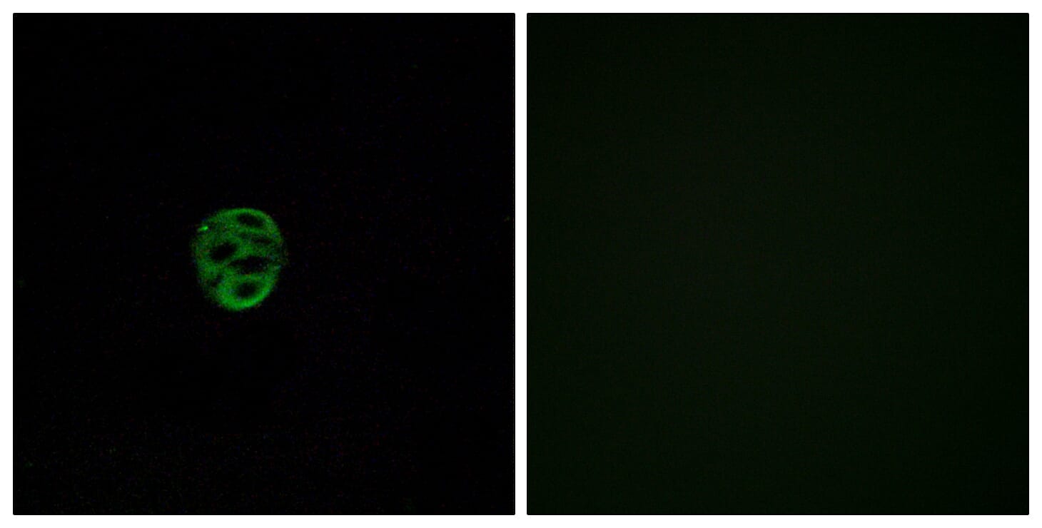 Immunofluorescence analysis of A549 cells using Anti-OR2AE1 Antibody. The right hand panel represents a negative control, where the antibody was pre-incubated with the immunising peptide.