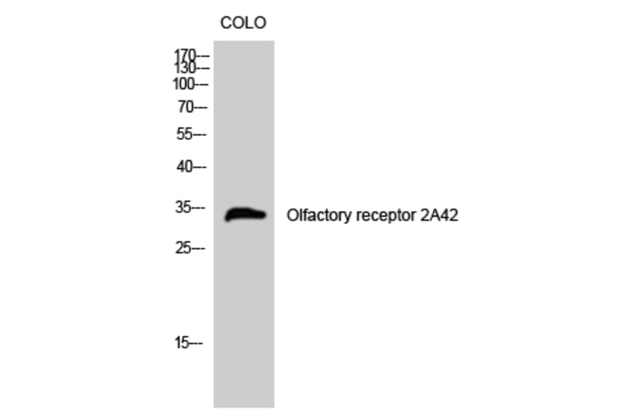 Western Blot - Anti-OR2A42 Antibody (G431) - Antibodies.com