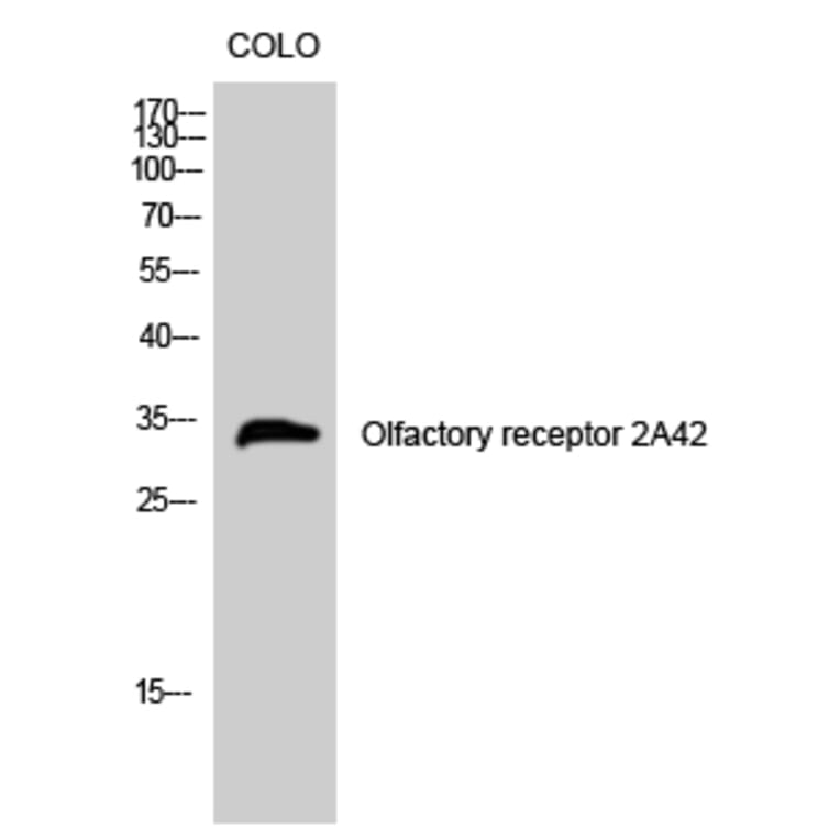 Western Blot - Anti-OR2A42 Antibody (G431) - Antibodies.com