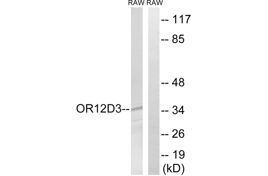 Western Blot - Anti-OR12D3 Antibody (G881) - Antibodies.com