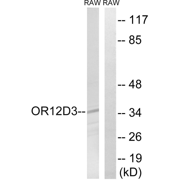 Western Blot - Anti-OR12D3 Antibody (G881) - Antibodies.com
