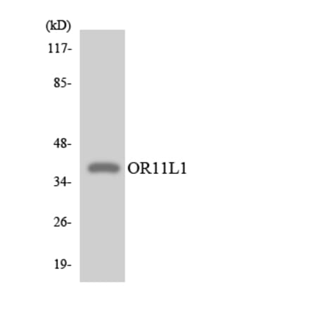 Western Blot - Anti-OR11L1 Antibody (R12-3146) - Antibodies.com