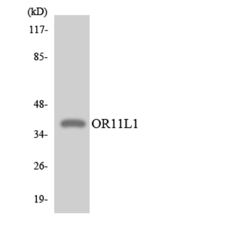 Western Blot - Anti-OR11L1 Antibody (R12-3146) - Antibodies.com