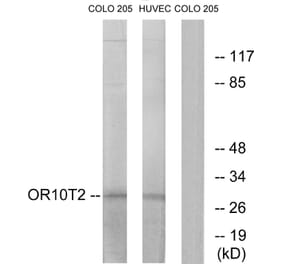 Western Blot - Anti-OR10T2 Antibody (G505) - Antibodies.com