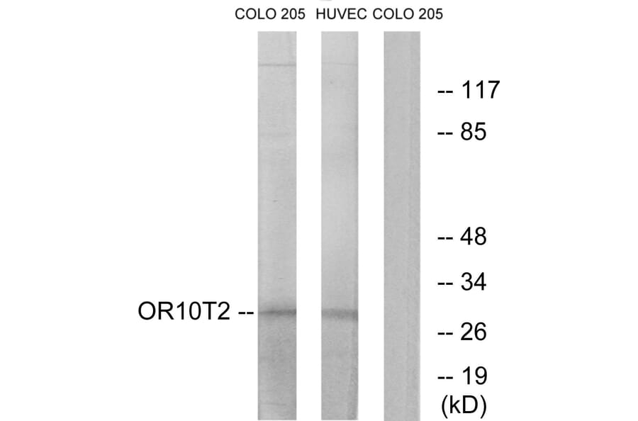 Western Blot - Anti-OR10T2 Antibody (G505) - Antibodies.com