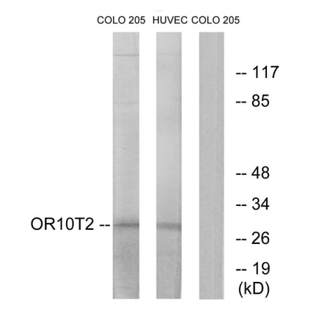 Western Blot - Anti-OR10T2 Antibody (G505) - Antibodies.com