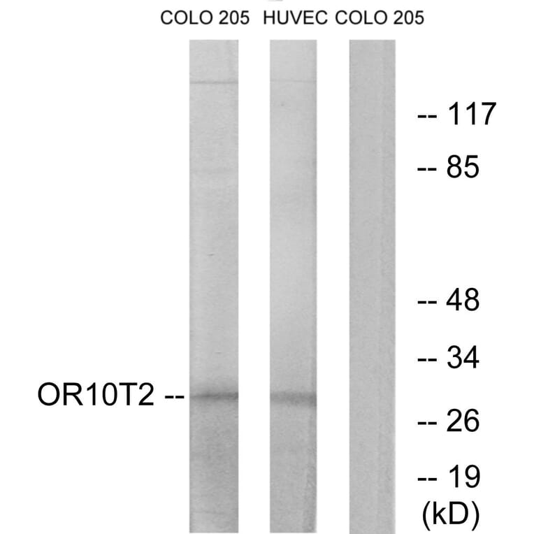 Western Blot - Anti-OR10T2 Antibody (G505) - Antibodies.com