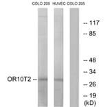 Western Blot - Anti-OR10T2 Antibody (G505) - Antibodies.com