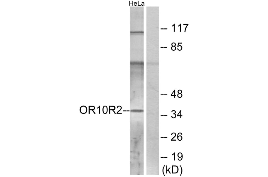 Western Blot - Anti-OR10R2 Antibody (G830) - Antibodies.com