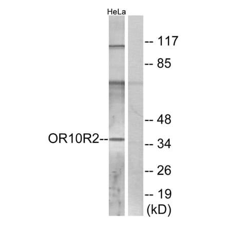 Western Blot - Anti-OR10R2 Antibody (G830) - Antibodies.com