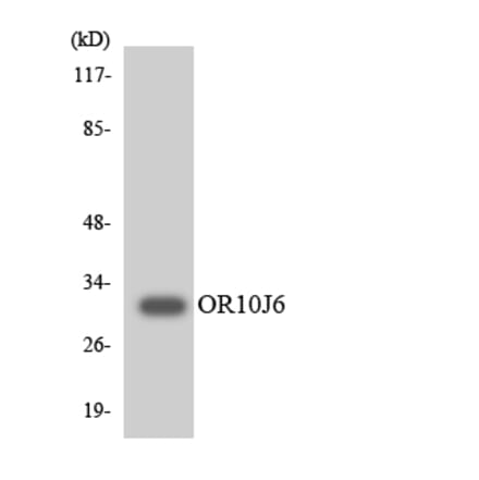 Western Blot - Anti-OR10J6 Antibody (R12-3137) - Antibodies.com