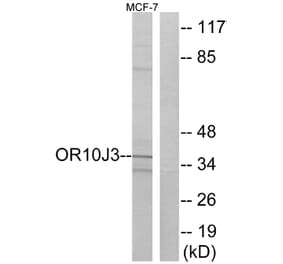 Western Blot - Anti-OR10J3 Antibody (G828) - Antibodies.com