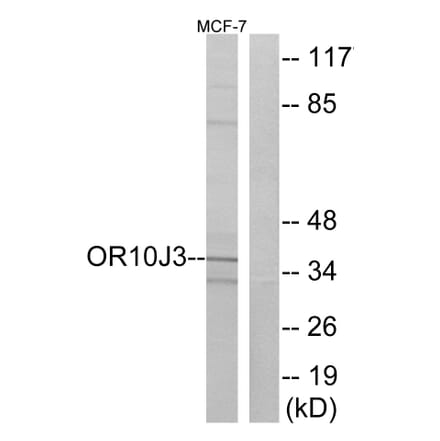 Western Blot - Anti-OR10J3 Antibody (G828) - Antibodies.com