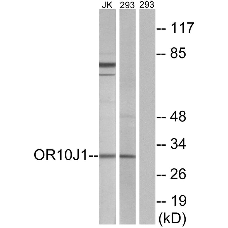 Western Blot - Anti-OR10J1 Antibody (G502) - Antibodies.com