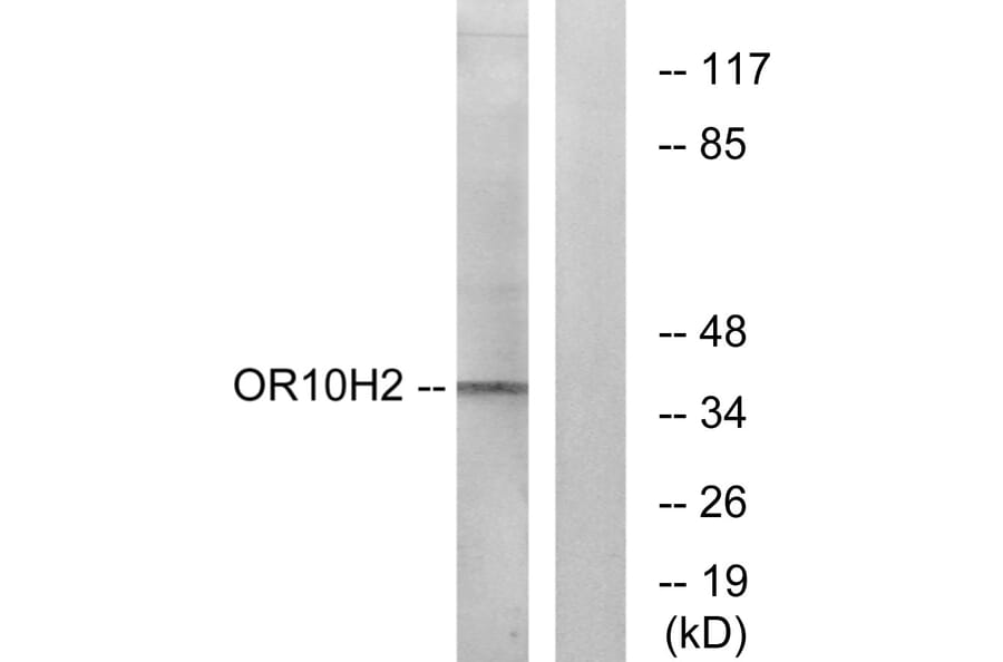 Western Blot - Anti-OR10H2 Antibody (G500) - Antibodies.com