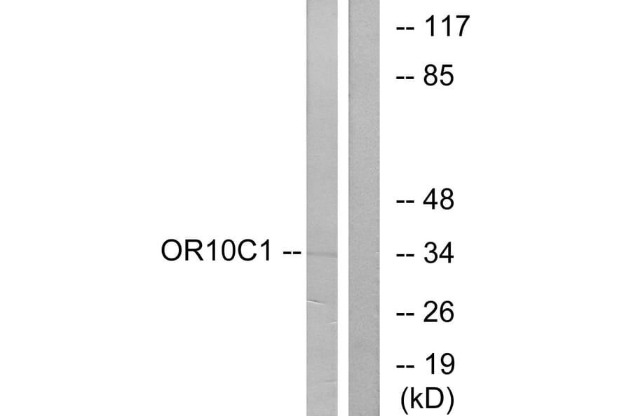 Western Blot - Anti-OR10C1 Antibody (G418) - Antibodies.com