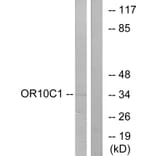 Western Blot - Anti-OR10C1 Antibody (G418) - Antibodies.com