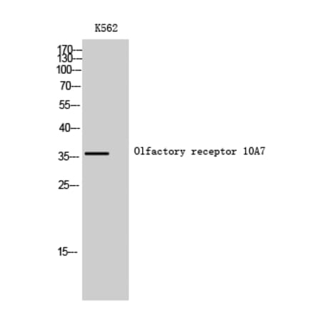 Western Blot - Anti-OR10A7 Antibody (G822) - Antibodies.com