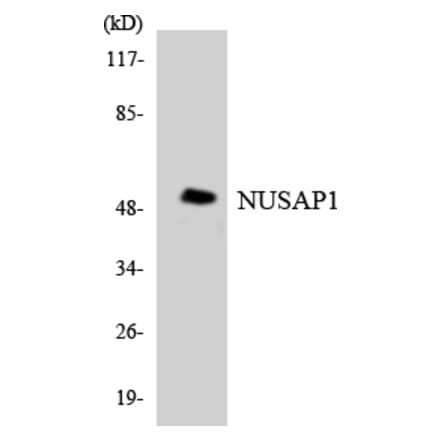 Western Blot - Anti-NUSAP1 Antibody (R12-3114) - Antibodies.com