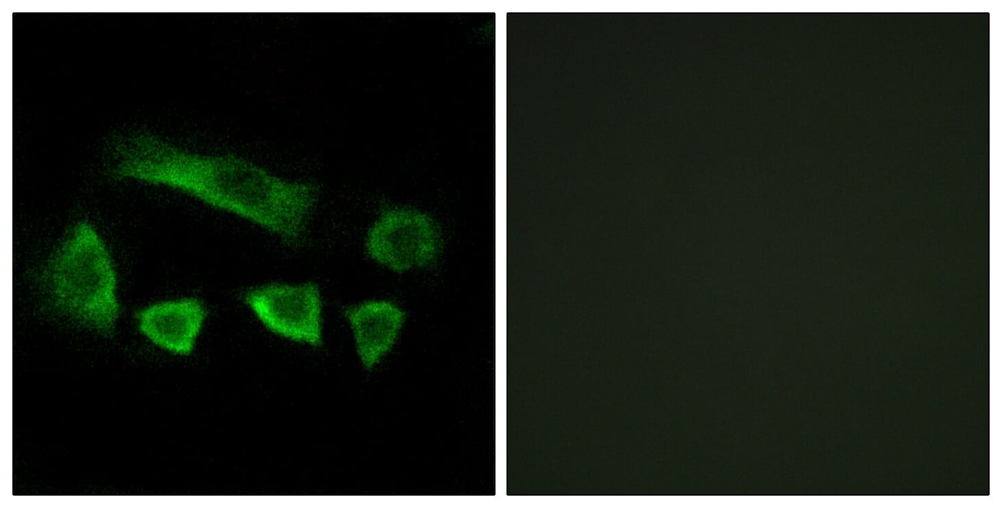 Immunofluorescence analysis of A549 cells using Anti-NT5C1B Antibody. The right hand panel represents a negative control, where the antibody was pre-incubated with the immunising peptide.